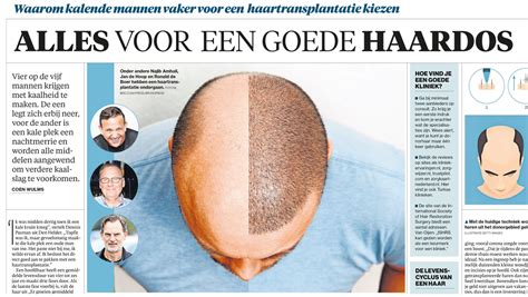 Waarom Kiezen Voor Haartransplantatie PRP?